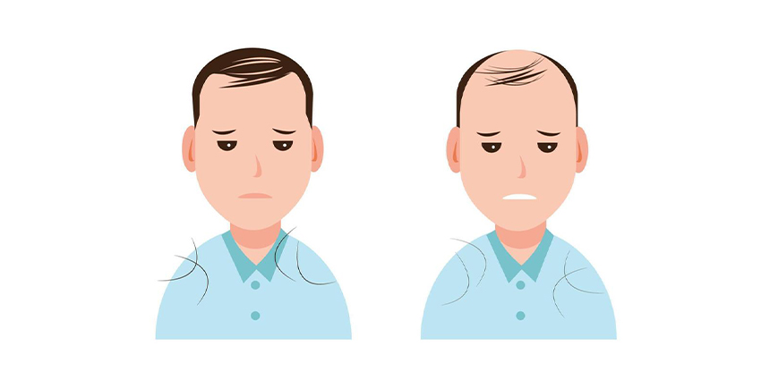 نکات کلیدی درباره مصرف دوتاستراید