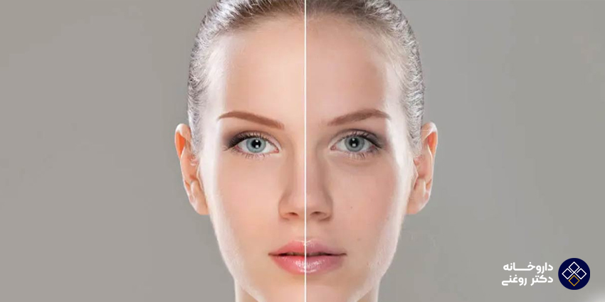 آشنایی با منابع غذایی طبیعی حاوی کلاژن