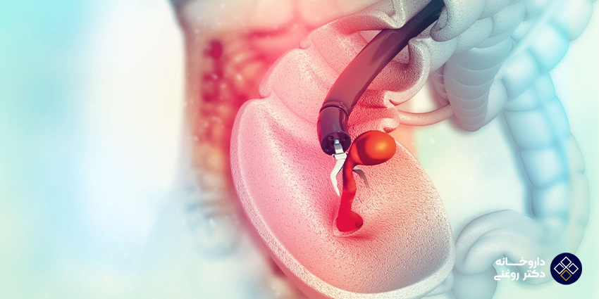 در طول کولونوسکوپی چه اتفاقی میافتد؟