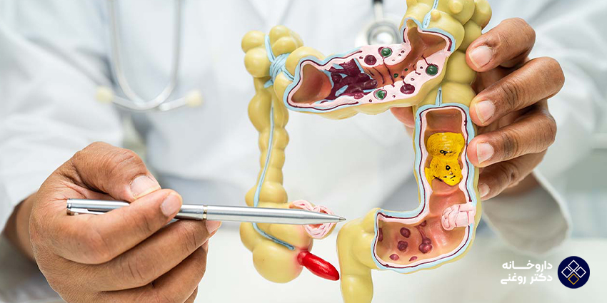 خطرات و عوارض احتمالی کولونوسکوپی