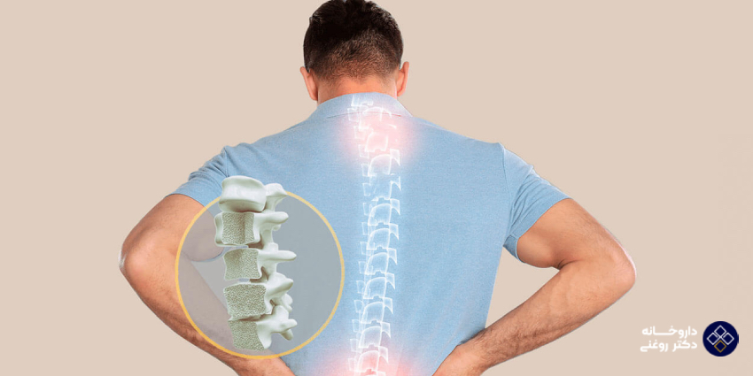 روموسوزوماب (Romosozumab) چگونه پوکی استخوان شدید را درمان می‌کند؟